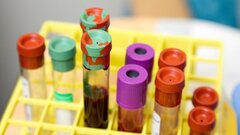 Ученые нашли простой способ предсказать шансы на выживание после инфаркта