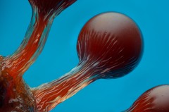 Строение спор слизевика Hemitrichia (плодовые тела)